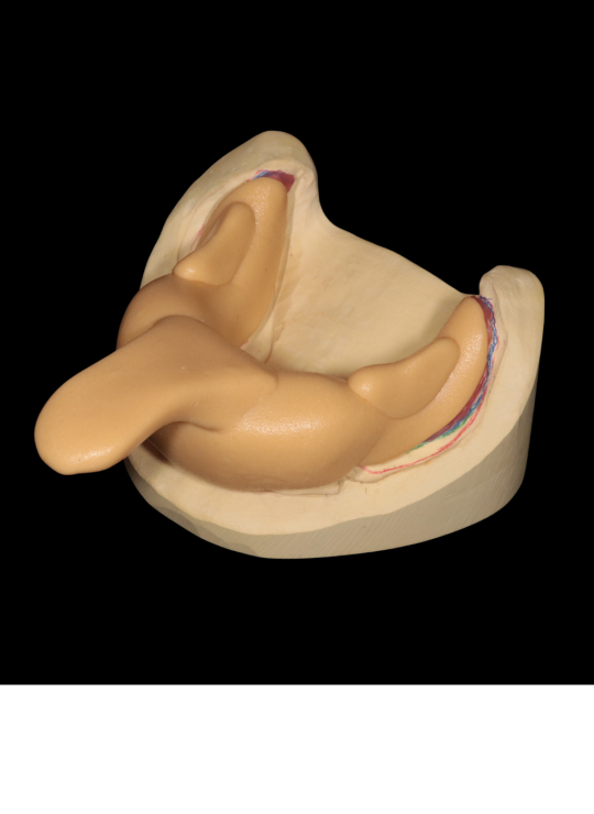 Kenitchi Matsuda course uk dentures (10)
