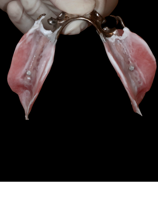 Kenitchi Matsuda course uk dentures (12)