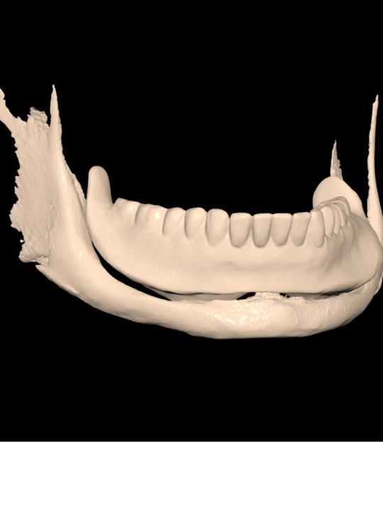 Kenitchi Matsuda course uk dentures (2)