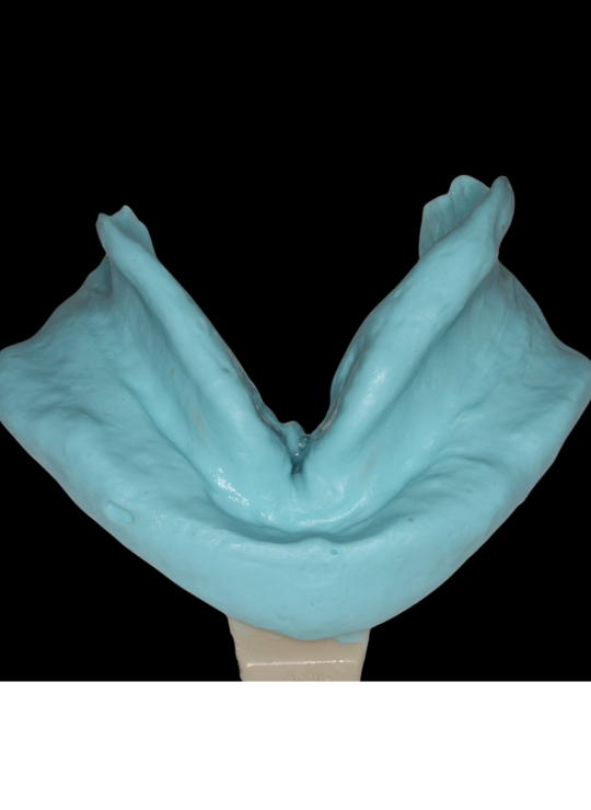 Kenitchi Matsuda course uk dentures (5)