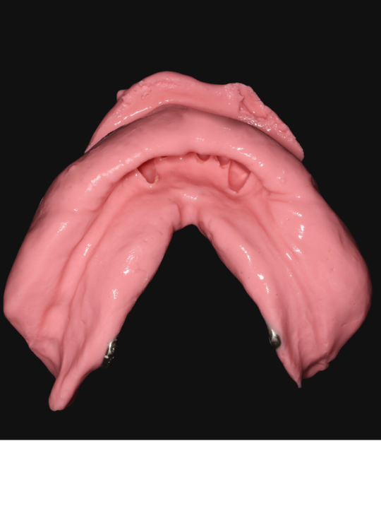 Kenitchi Matsuda course uk dentures (7)