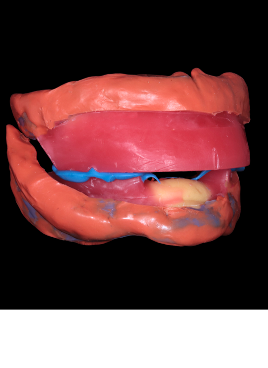 Kenitchi Matsuda course uk dentures (8)