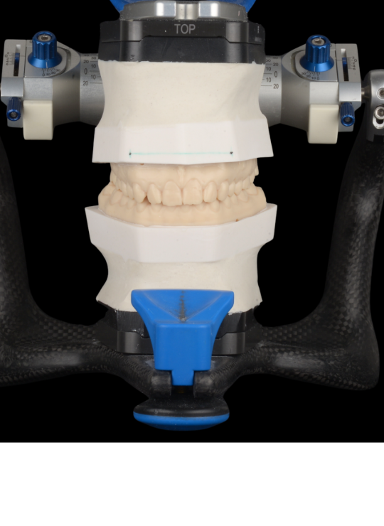 composite bonding course (2)