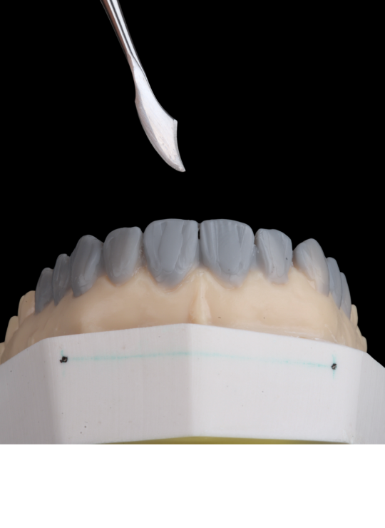 composite bonding course (3)